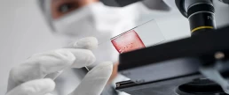 biopsia de endomentru la centrul Medis